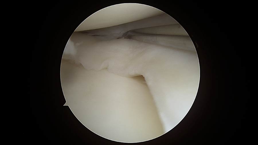 Ortopedico Ginocchio Firenze